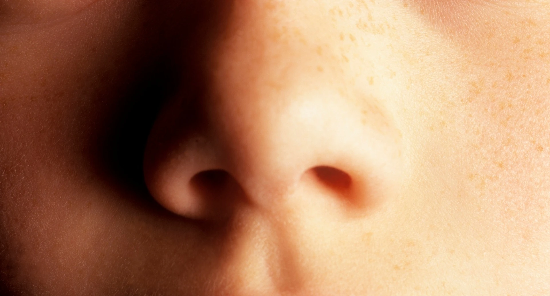 A woman who noticed her husband developed a distinctive smell has led to skin-secreted volatile biomarkers indicating Parkinson's disease being identified
