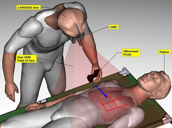 The CAMDASS augmented reality system provides untrained personnel with instant medical know-how (Image: ESA/Space Applications Service NV)