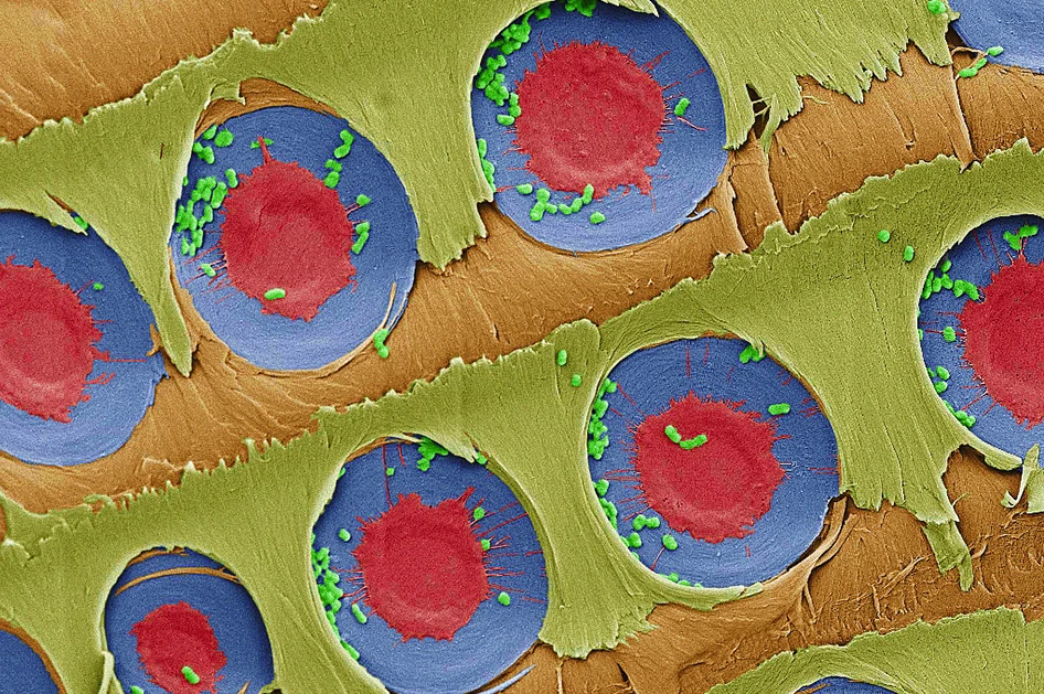 In this false-color image, E. coli bacteria (green dots) can be seen trapped around pit membranes (red and blue) in pine sapwood
