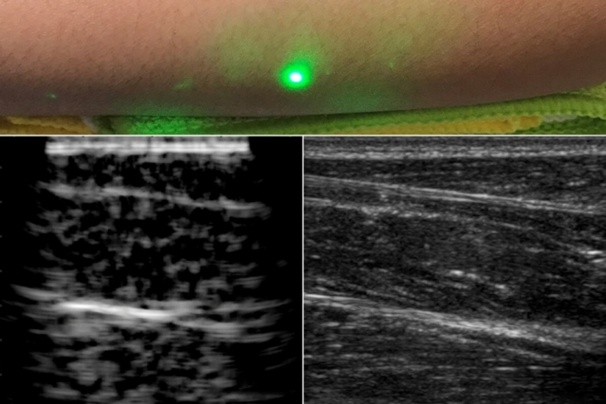 The first image of human tissue using the new laser ultrasound technique (left) compared to the current traditional ultrasound method (right)