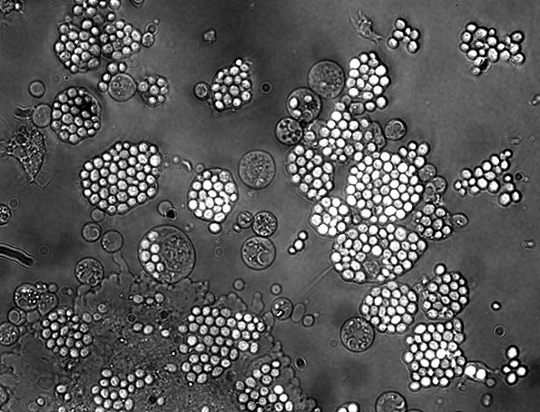An oxygen burst released from leukocytes, magnified 20 times (Image: ESA)