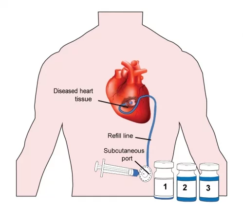 An overview of the vision for the clinical translation of Therepi
