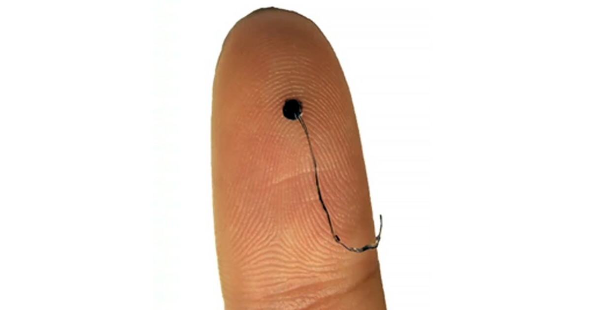 Single hair-like electrode outperforms traditional 21-lead EEG