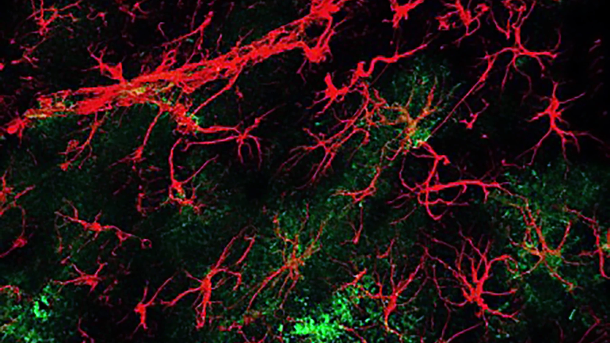 Overproduction of hevin (green) by astrocyte cells (red) reversed cognitive impairment in mice