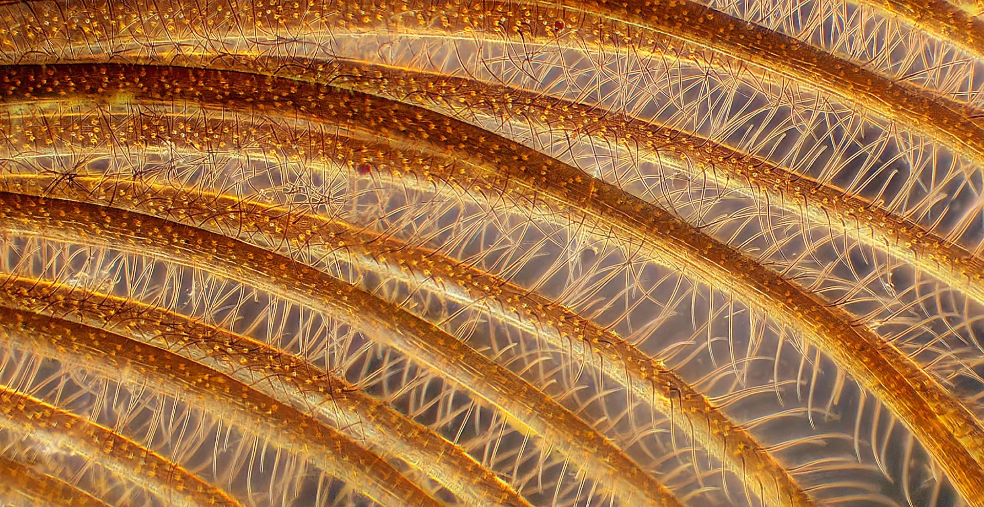 Image of Distinction: Male gypsy moth antenna