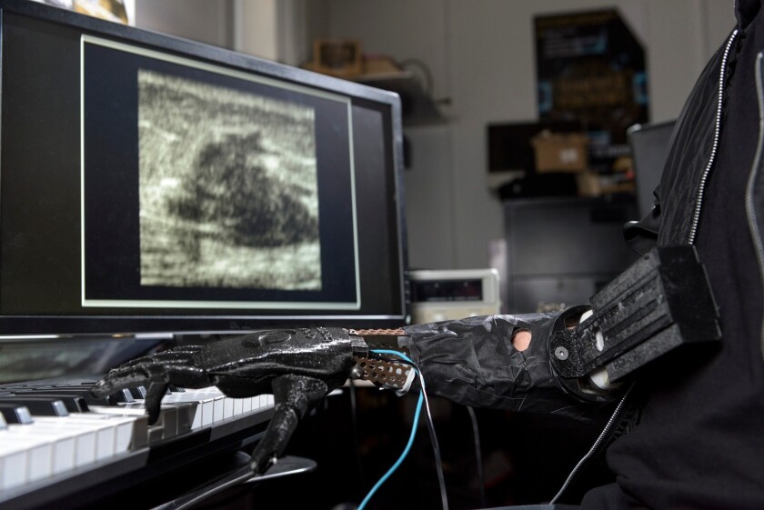 The robotic arm developed at Georgia Tech uses ultrasound sensors to allow finer control over the fingers