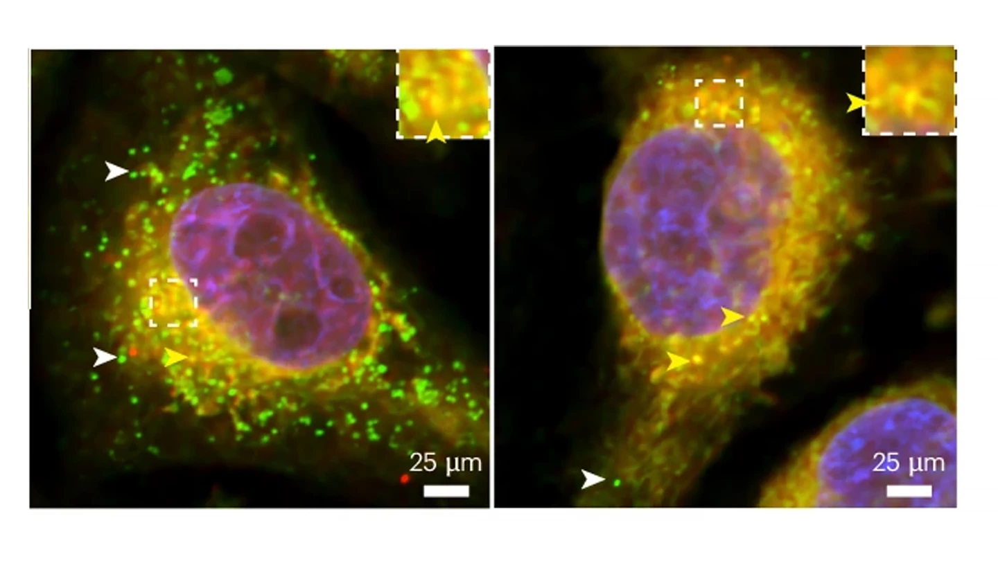 Loss of tau disrupts the budding of lipid droplets. White arrowheads mark mature droplets that have successfully budded from the cell; yellow arrowheads mark future droplets that need to bud to become mature droplets
