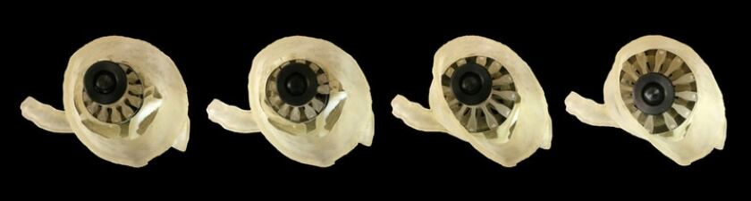 The sizer device developed by scientists to help determine the correct size for artificial heart valves ahead of implantation