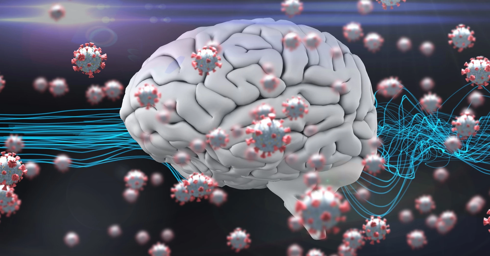 A new study has found distinct parallels between COVID-19 and Alzheimer's disease