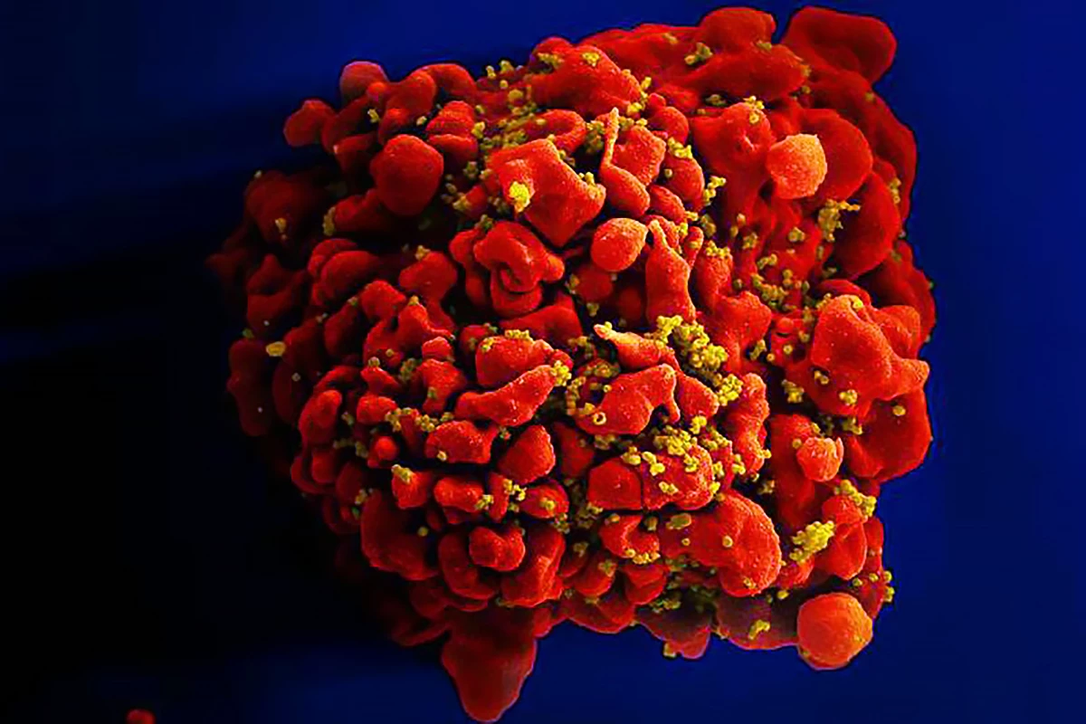 Scientists now know how HIV (the tiny yellow particles seen here) integrates into the human genome