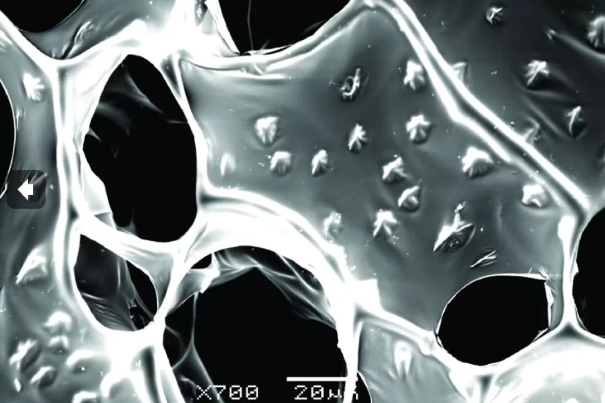 A scanning electron microscope image of the nanowire-alginate composite scaffolds, showing the star-shaped clusters of nanowires (Image: Disease Biophysics Group, Harvard University)