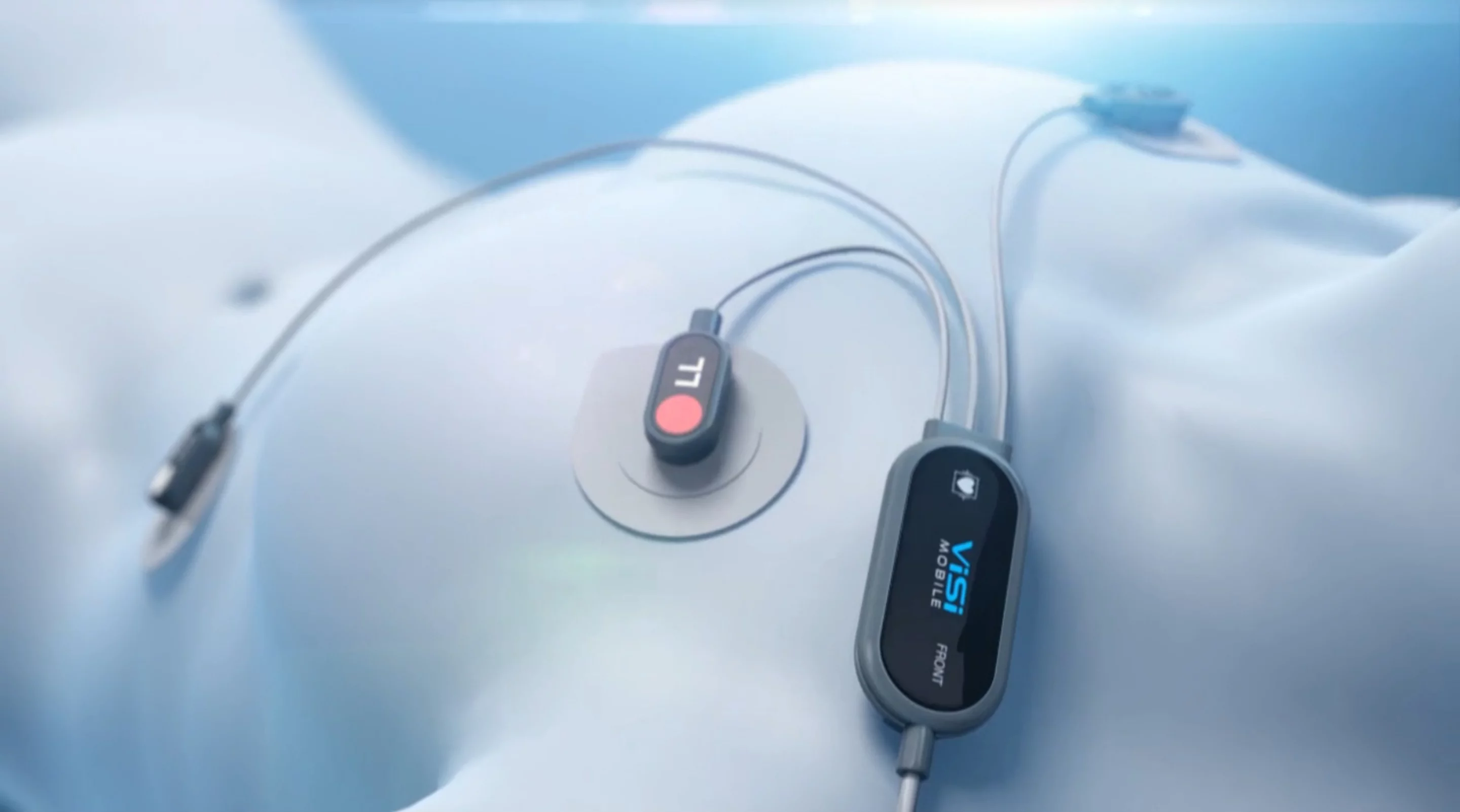 ViSi Mobile chest unit