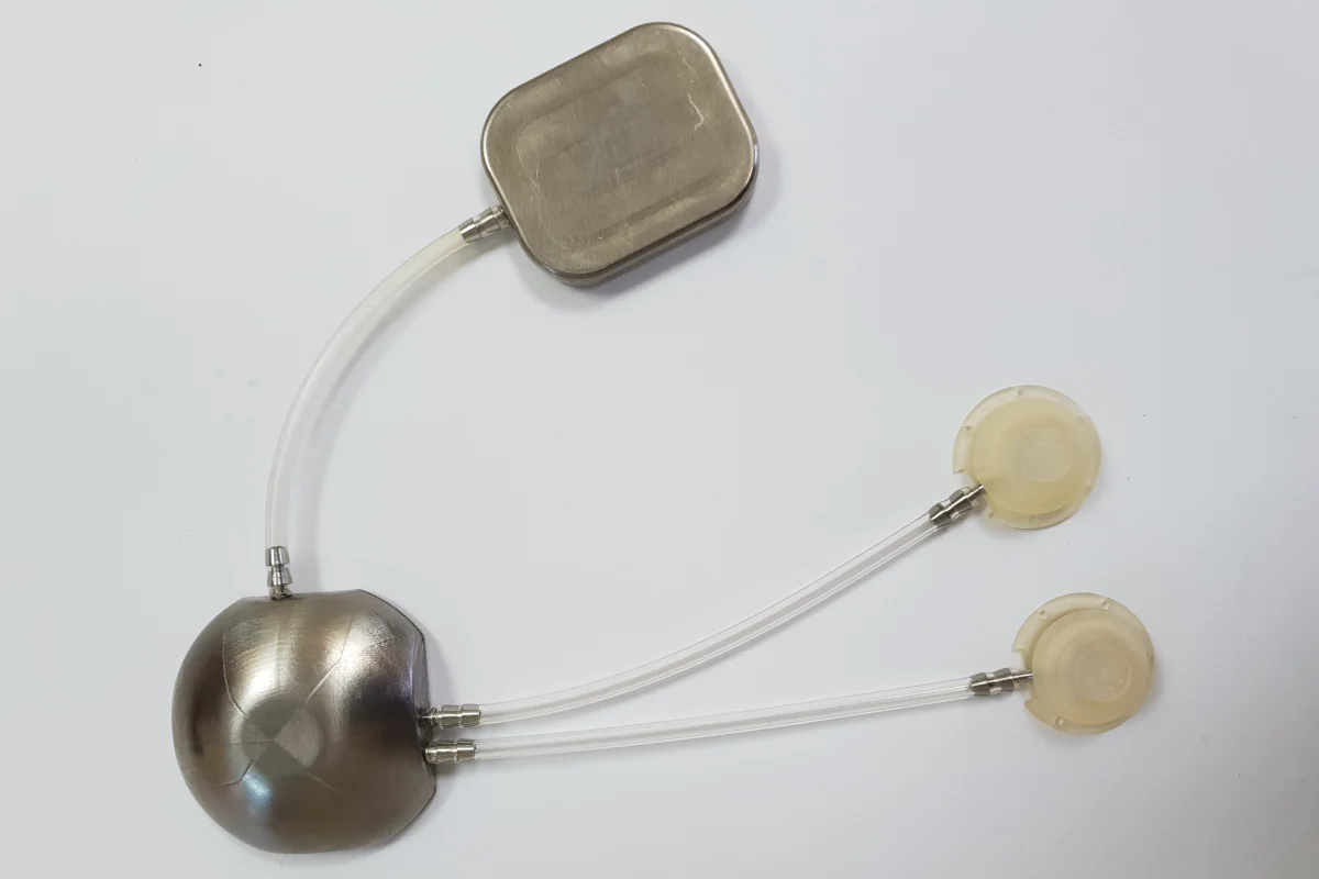 Beta O2 Artificial pancreas uses oxygen tank to better-produce insulin