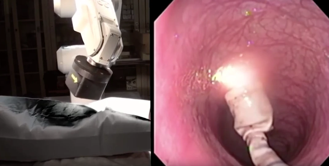 The capsule on the right is directed by a robotically controlled magnetic arm, as seen on the left