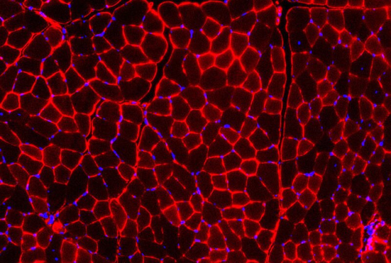 Lose fat without losing muscle: A booster of this protein might be the solution ?url=http%3A%2F%2Fnewatlas Brightspot.s3.amazonaws.com%2F35%2F5c%2F53ea2d9f40eb915936bc2734c7b3%2F25 Pr Evans Microscopy