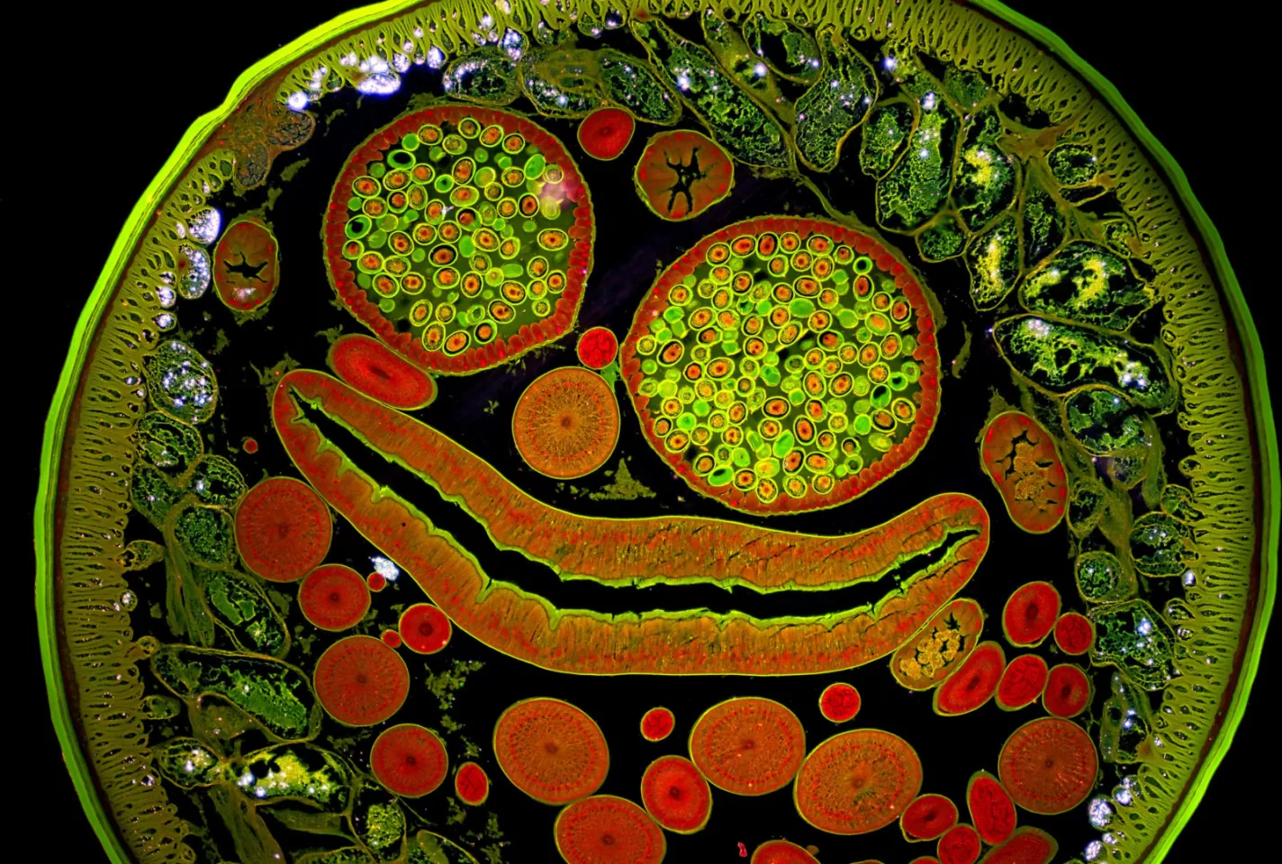 Image of Distinction: Ascaris lumbricoides (parasitic roundworm)