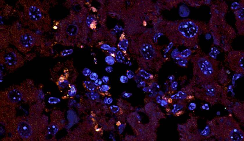 Orange dots represent the gut bacterium known to cause an autoimmune disease in liver tissue