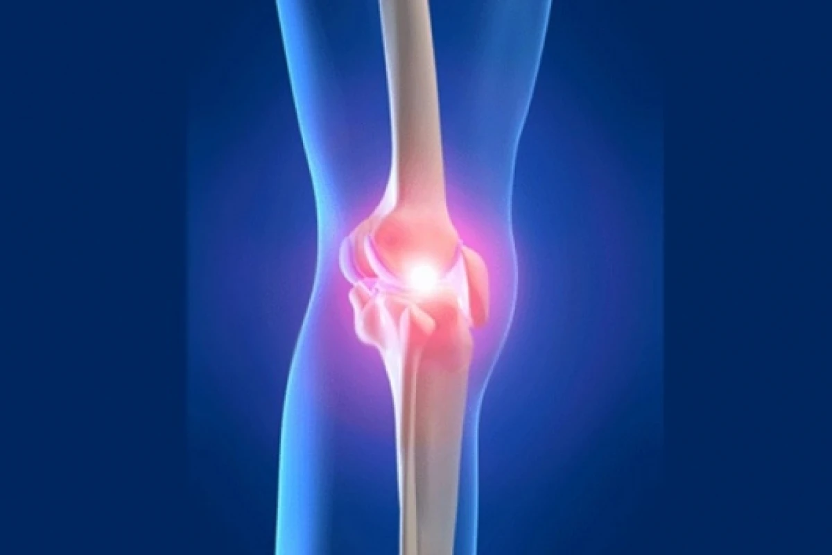 The new scaffold mimics bone and cartilage when implanted into a joint
