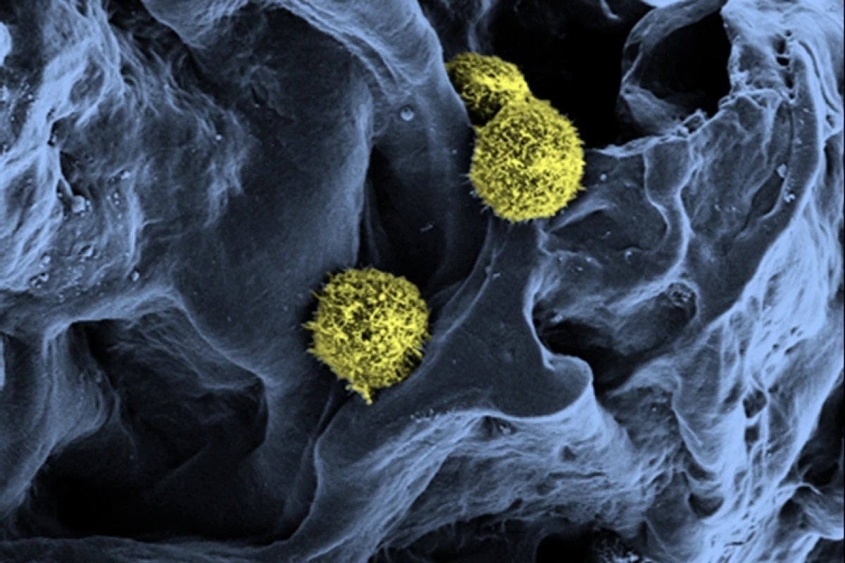 Scanning electron microscopy of stem cells (yellow / green) in a scaffold structure (blue) serving as a basis for the artificial bone marrow (Photo: C. Lee-Thedieck/KIT)