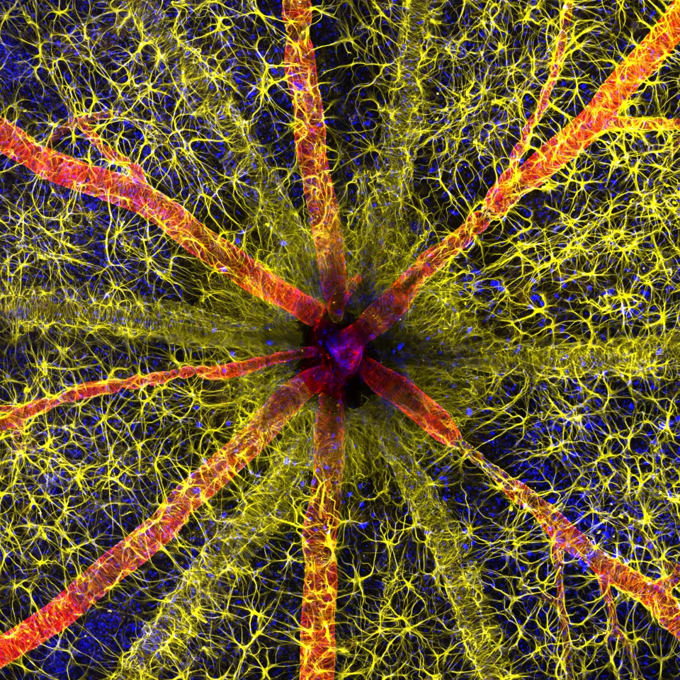 1st place winner. Rodent optic nerve head showing astrocytes (yellow), contractile proteins (red) and retinal vasculature (green)