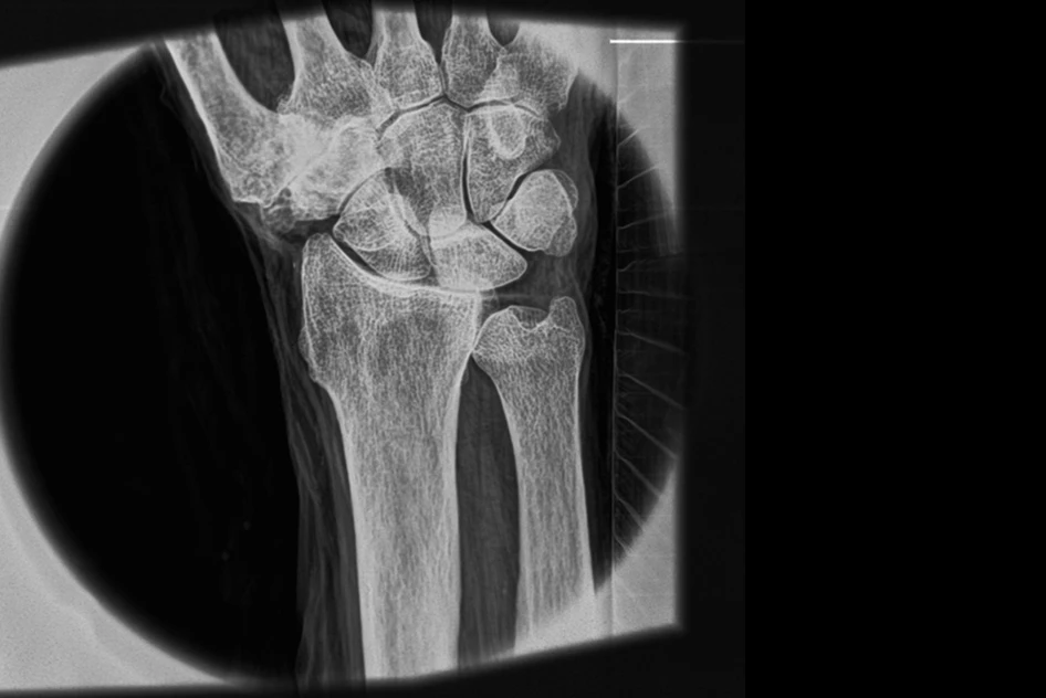 An X-ray of a human wrist demonstrates the system's ability to reveal soft-tissue structures and very fine detail (Photo: MIT)