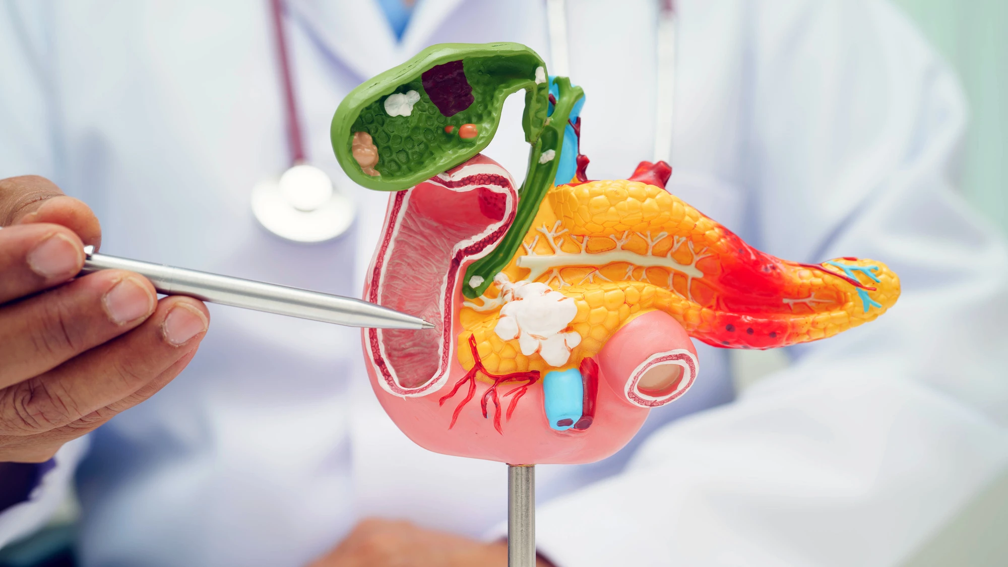 A new protein discovery could lead to more effective treatments for one of the deadliest cancers