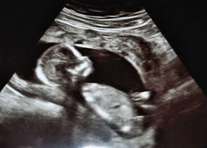 A newly developed acoustic rectifier could improve the image quality of sonograms (Photo: myllissa via Flickr)