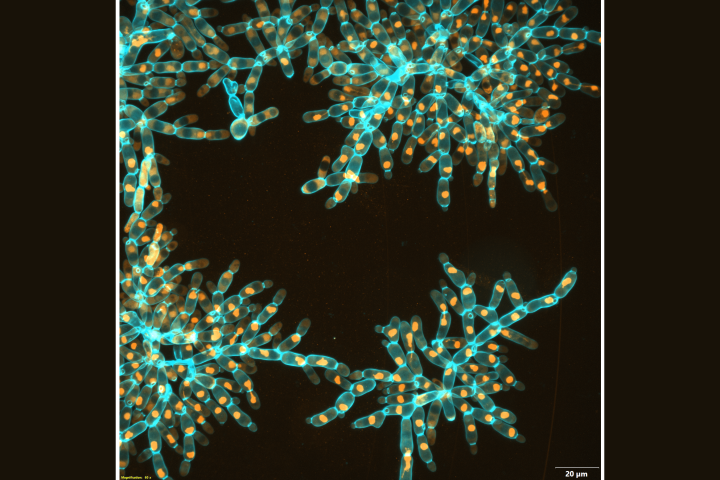 Microscope images of modules of "evolved" yeast with elongated cells, forming larger clusters