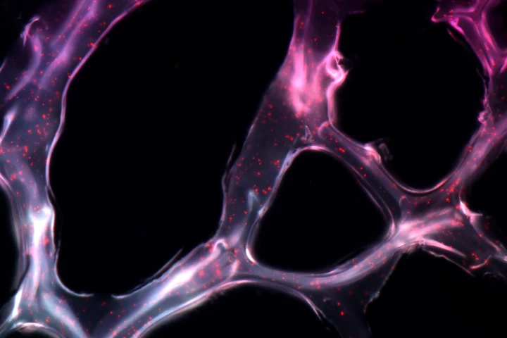 The researchers embedded triple helix microRNA particles into a gel and used it to successfully tackle tumors in mice