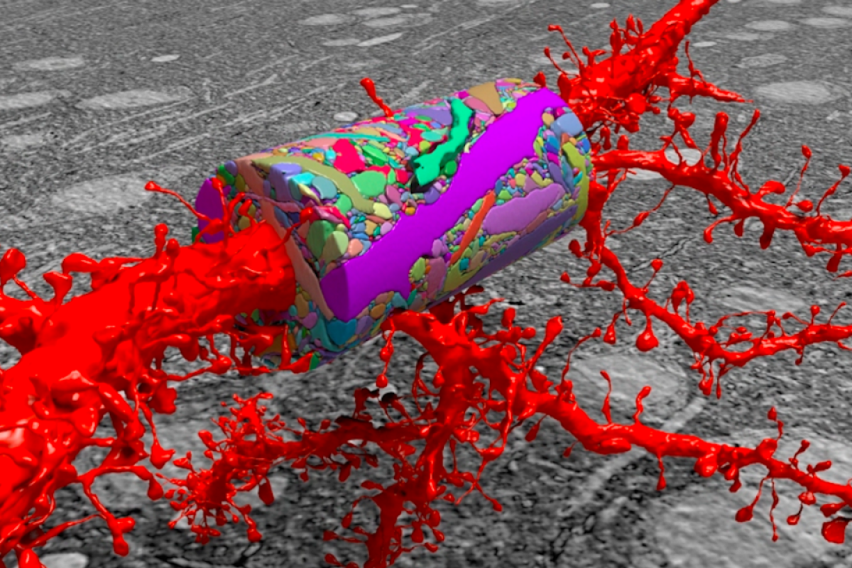 Can We Build A Complete Wiring Diagram Of The Human Brain