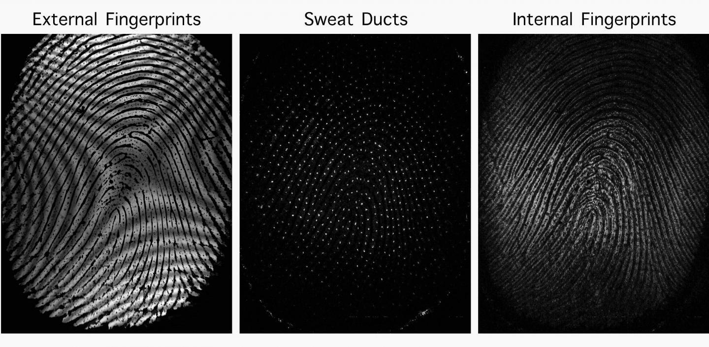 Images acquired using the new technology, which also images sweat ducts