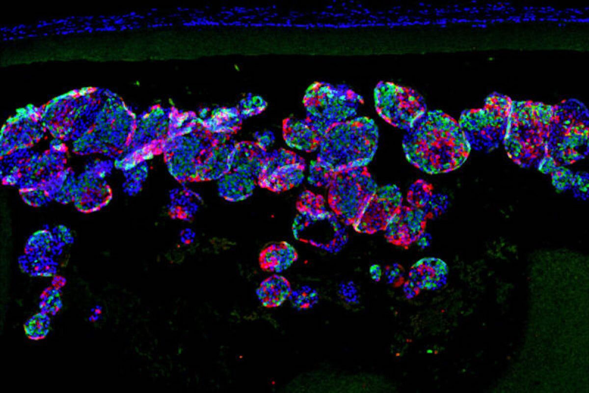 beta cells insulin