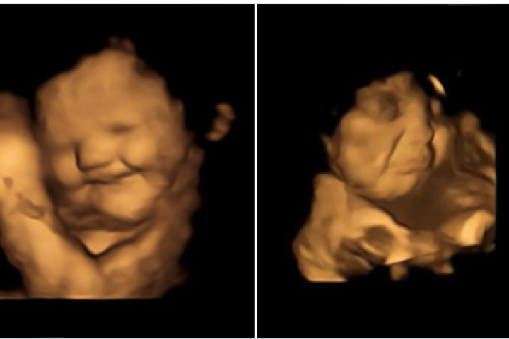 On the left is a baby happily responding to the sweet taste of carrot and on the right is a baby grimacing at the bitter taste of kale