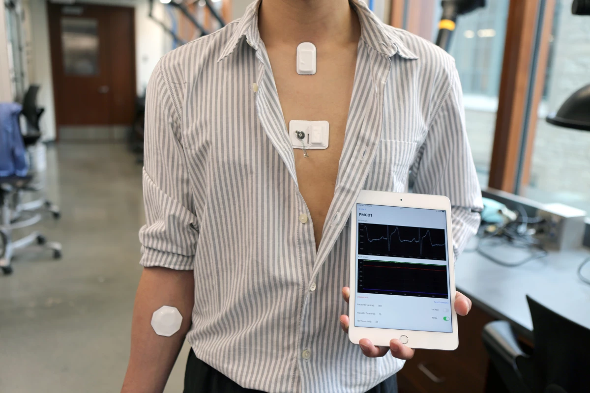 The pacemaker communicates with four wearable modules, which in turn relay real-time heart data to a mobile device