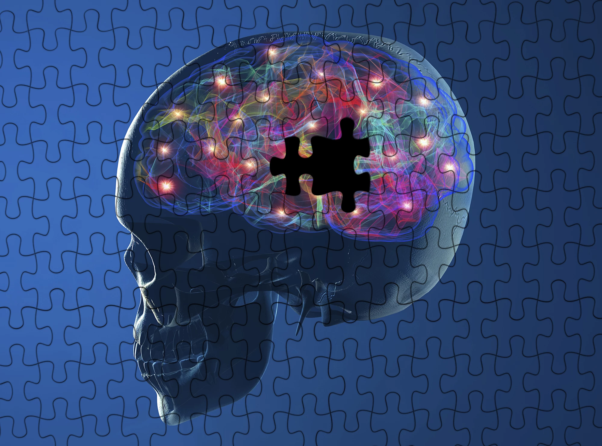 An early biomarker of Alzheimer's may be changes to glucose metabolism protein patterns