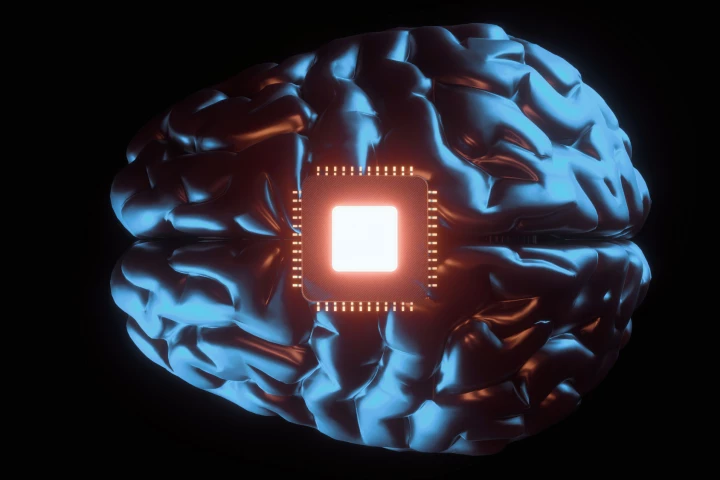 What happens to the implant in your brain when it becomes obsolete or its manufacturer goes bust?
