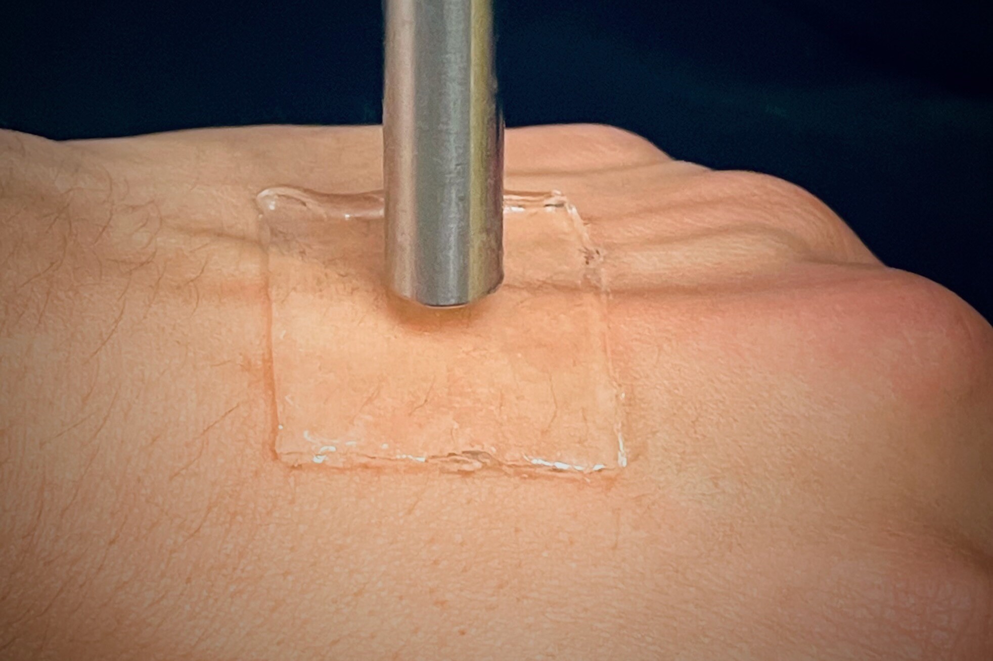 Hydrogel bandage uses ultrasound to better stick to the skin