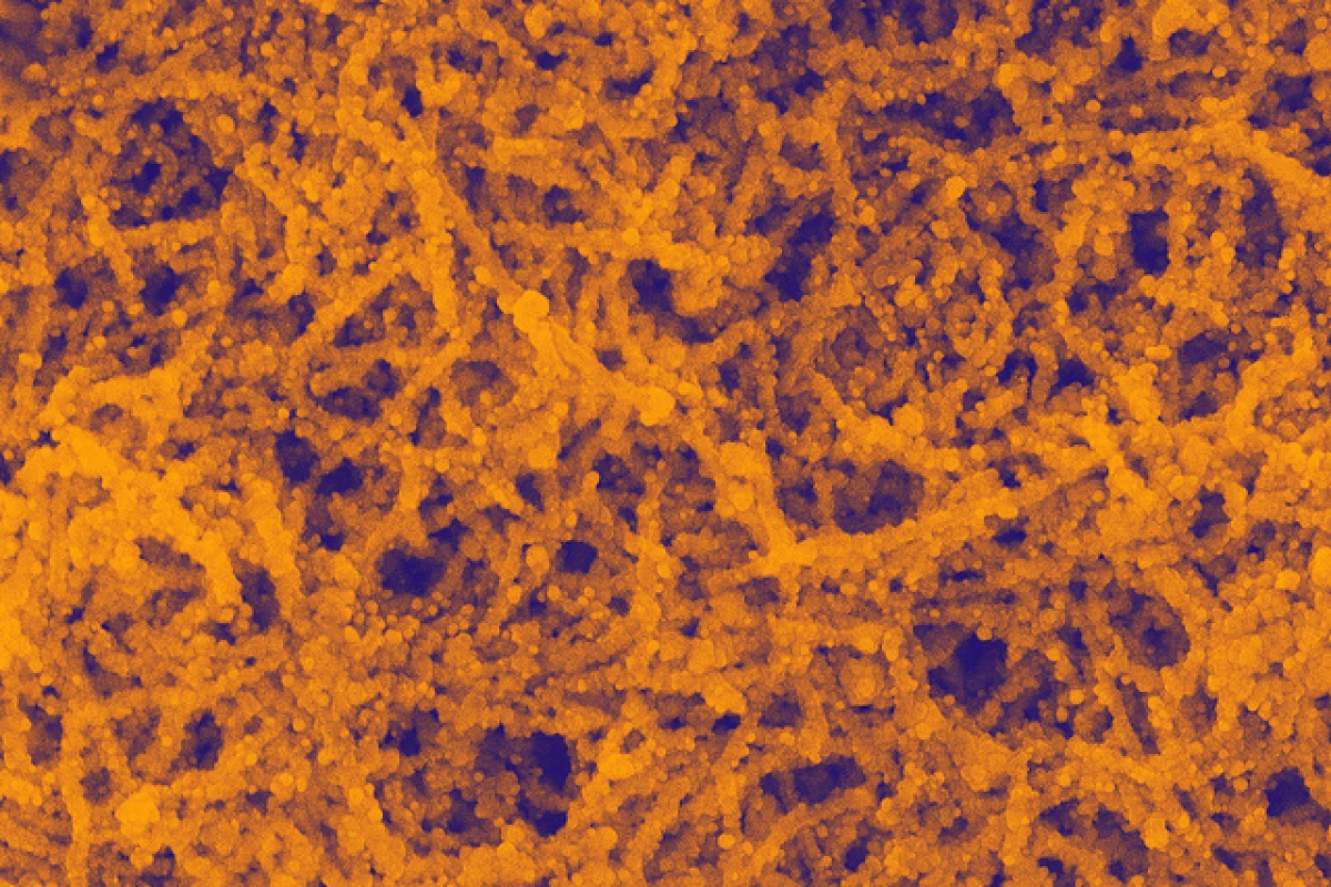 Researchers have boosted the efficiency of organic solar cells by 20 percent through the use of gold nanoparticles (Image: Gold nanoparticles in nanowires - Argonne National Laboratory)