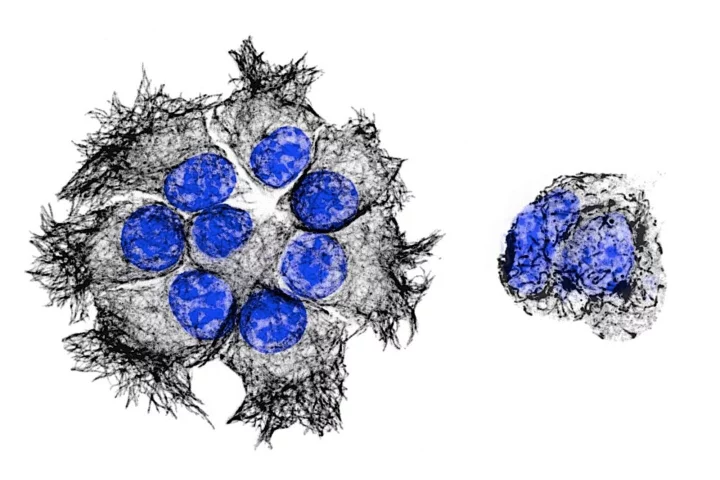 The left image shows clusters of pancreatic cancer cells, while the right image shows cancer treated with the new drug PTC596 (DNA in blue, black are the microtubule structures targeted by the drug)