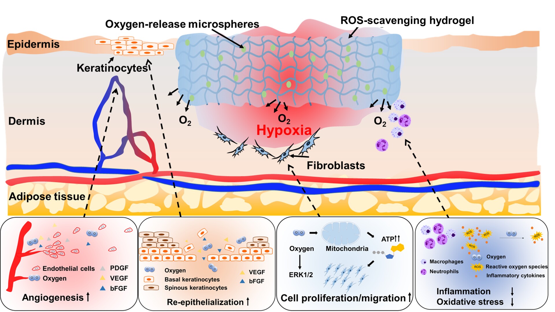 Hydrogel produces oxygen to help heal chronic wounds