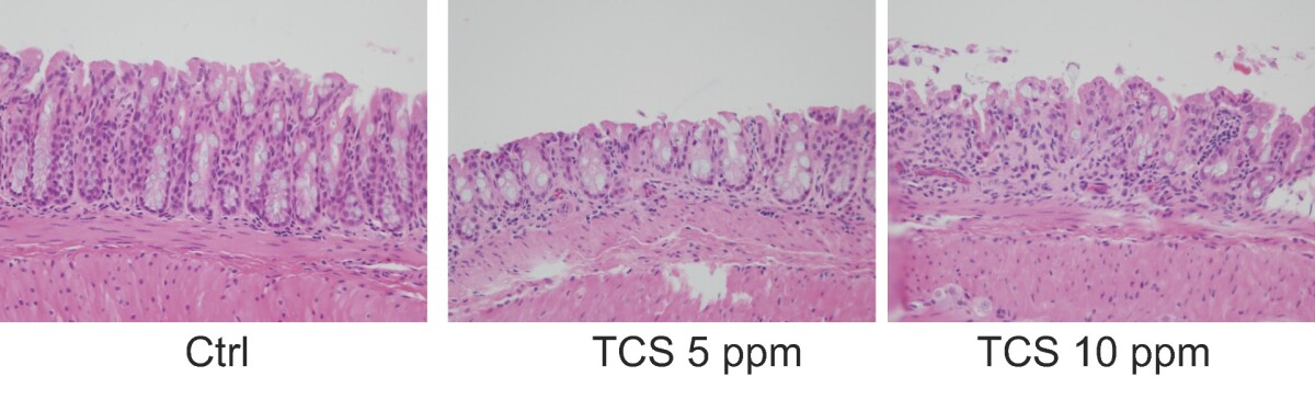 Exposure to triclosan in mice demonstrating increased inflammation