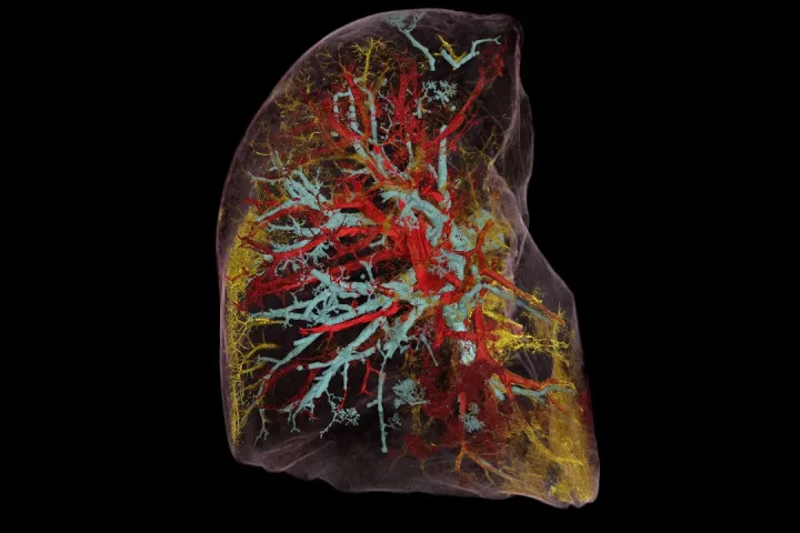 A new X-ray technology allows for whole organs to be imaged down to a resolution of one micron