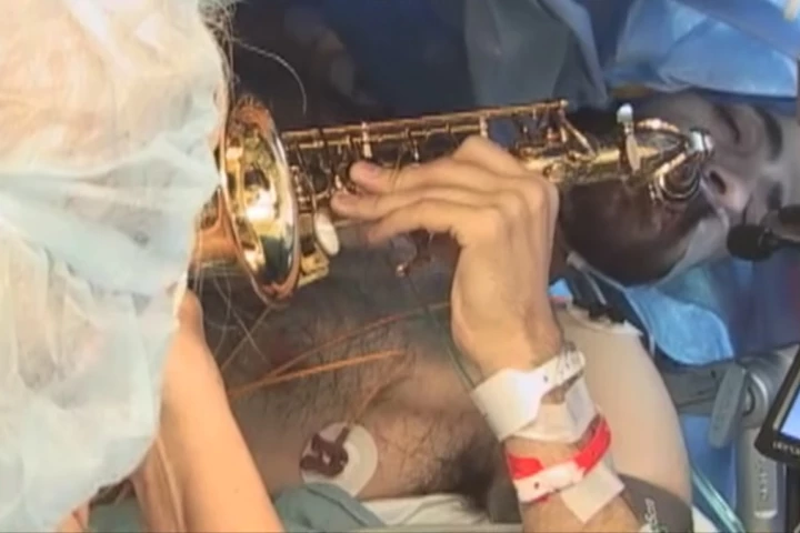 Musician and music teacher Dan Fabbio played the saxophone during brain surgery, to help prevent doctors damaging the parts of his brain associated with musical processing