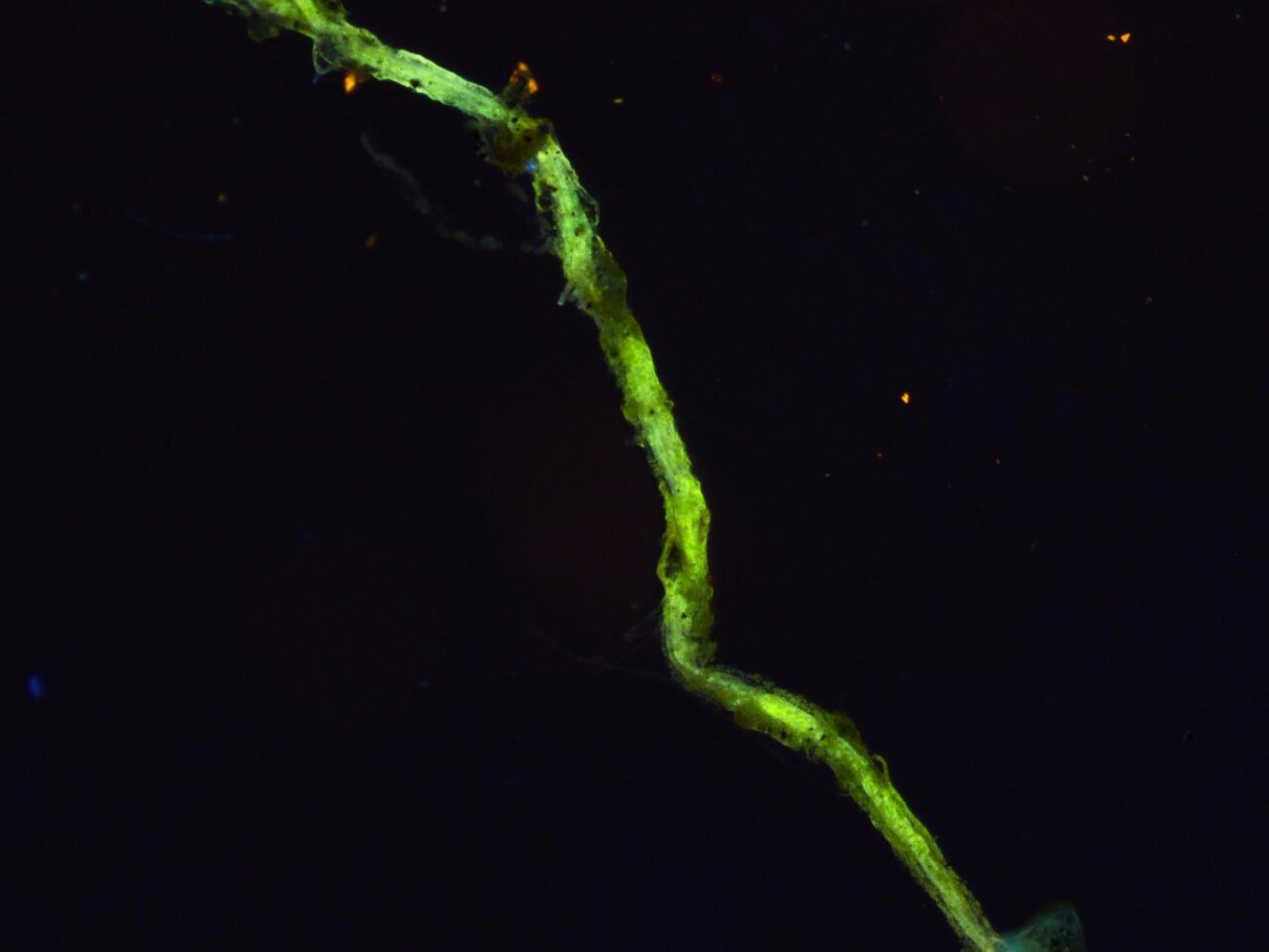 A close-up of a single filament with bacteria cells on its body