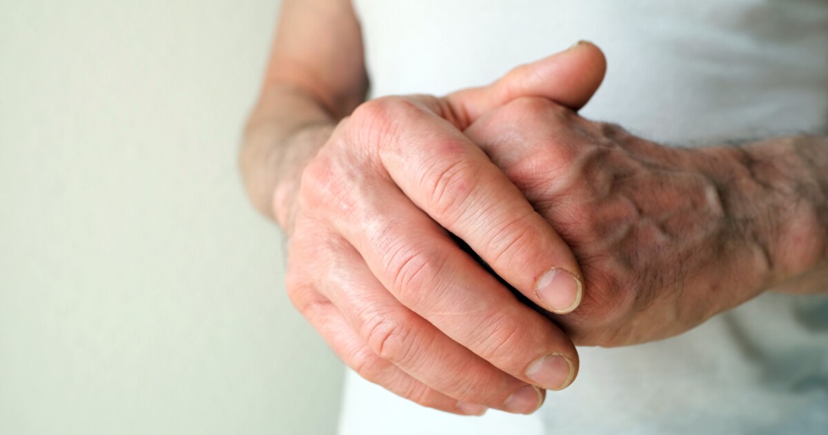Early immune aging may predict rheumatoid arthritis Early immune aging may predict rheumatoid arthritis