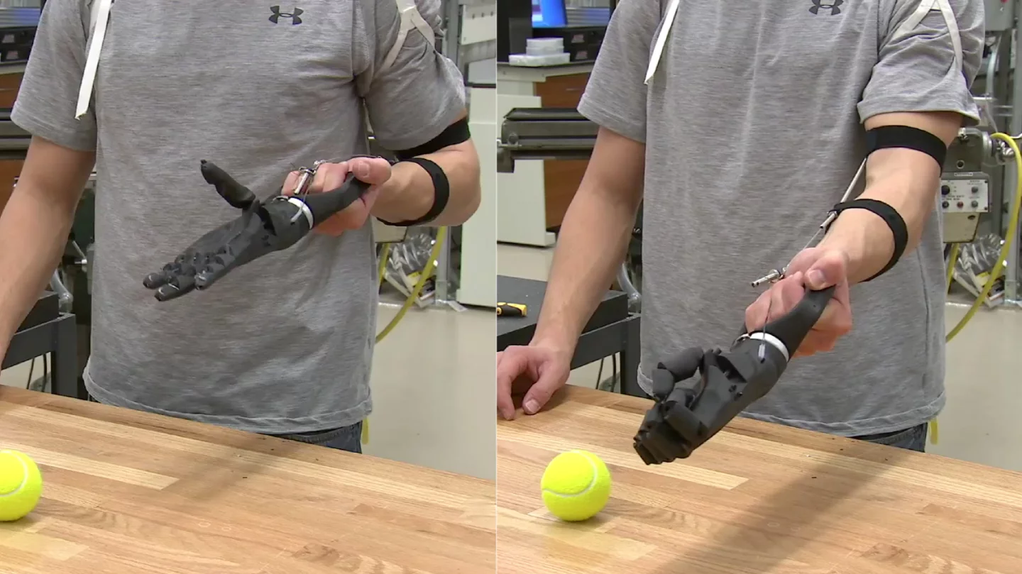 Eric Ronning's ReHand, made mostly out of parts fabricated by a 3D printer, costs just US$20 dollars in materials