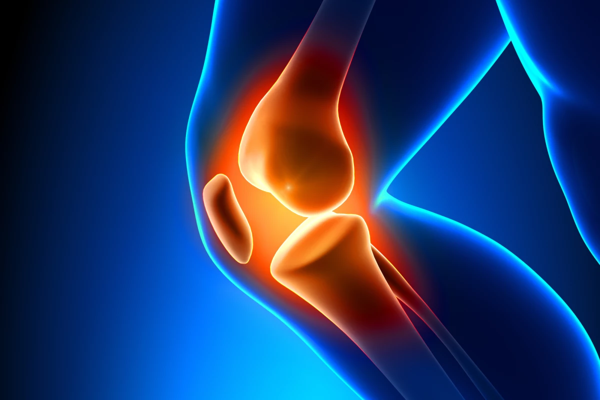 A new type of scaffold could give boost the recovery of torn ligaments and tendons