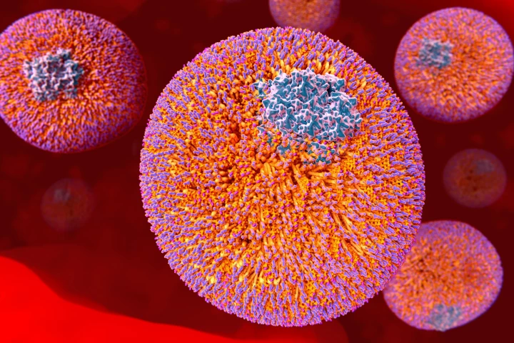 Researchers have used gene-editing tech to permanently switch off production of LDL cholesterol in people genetically predisposed to having levels of the bad cholesterol