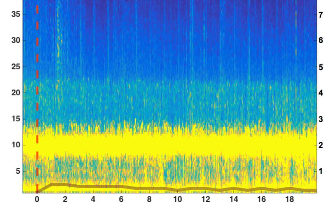 Graph of brainwave activity in patients after administration of a placebo