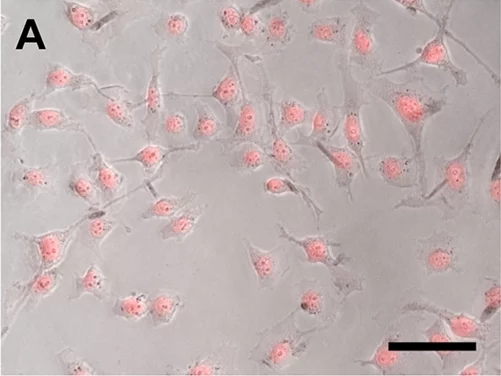 The cells in this image have turned fluorescent pink, showing that the new drug delivery system results in high cellular uptake after being irradiated by near infrared light